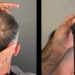 HairFiberPlus: fibre naturali per un effetto di maggiore densità dei capelli
